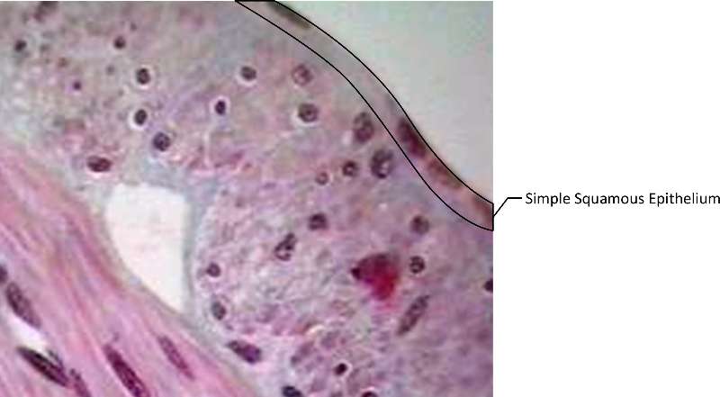 Simple Squamous Epithelium micrograph